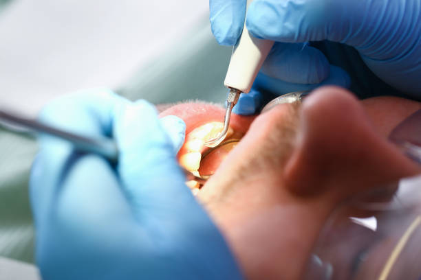 Best Urgent Tooth Repair  in Alpine, CA